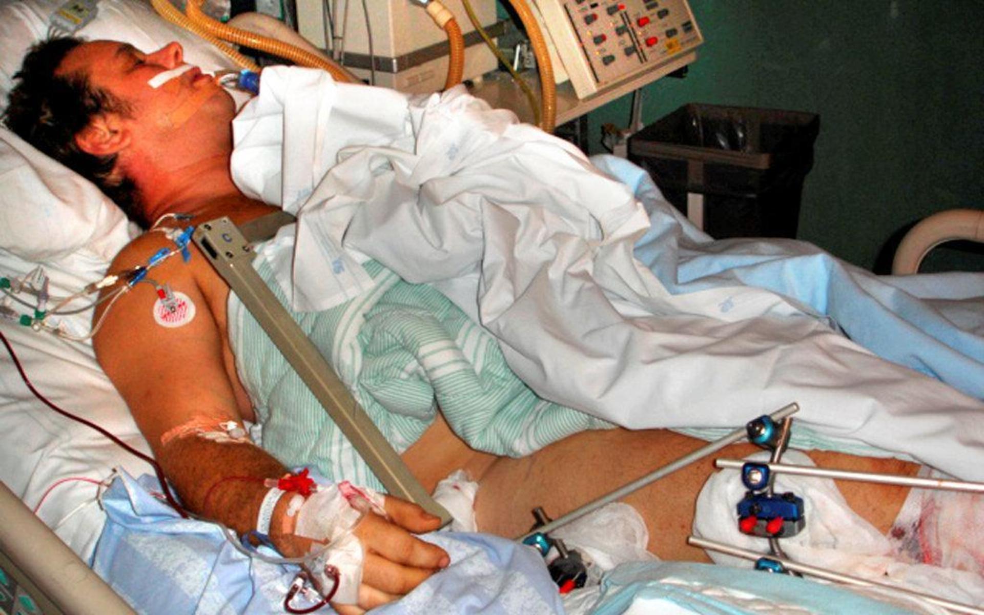 Johan Hermansson låg nedsövd efter den hemska olyckan i oktober 2006. Han hade allvarliga skador över nästan hela kroppen.