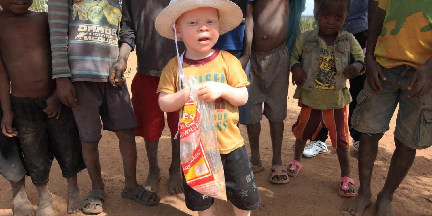 Treåriga Cassim Jaffalies pappa sade upp sig från sitt jobb för att kunna skydda sin son från de ökade attackerna på barn med albinism. Arkivbild från Malawi.