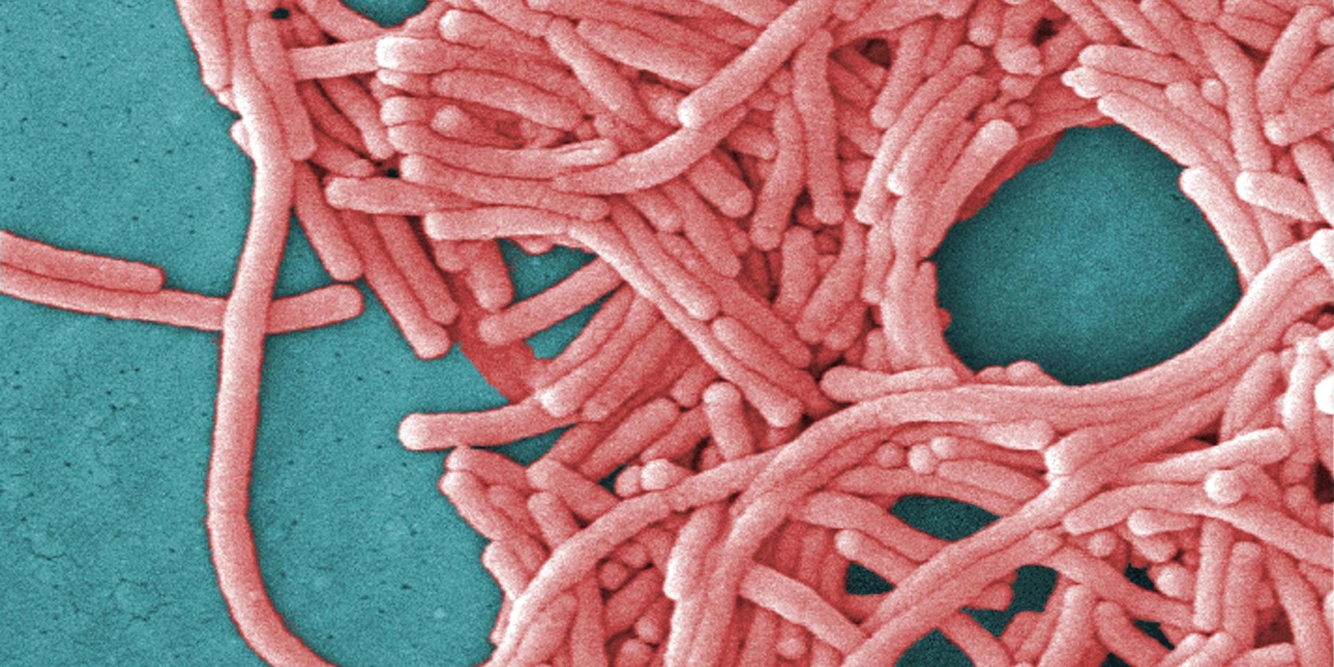 Legionellabakterier sedda genom att mikroskop. Arkivbild.