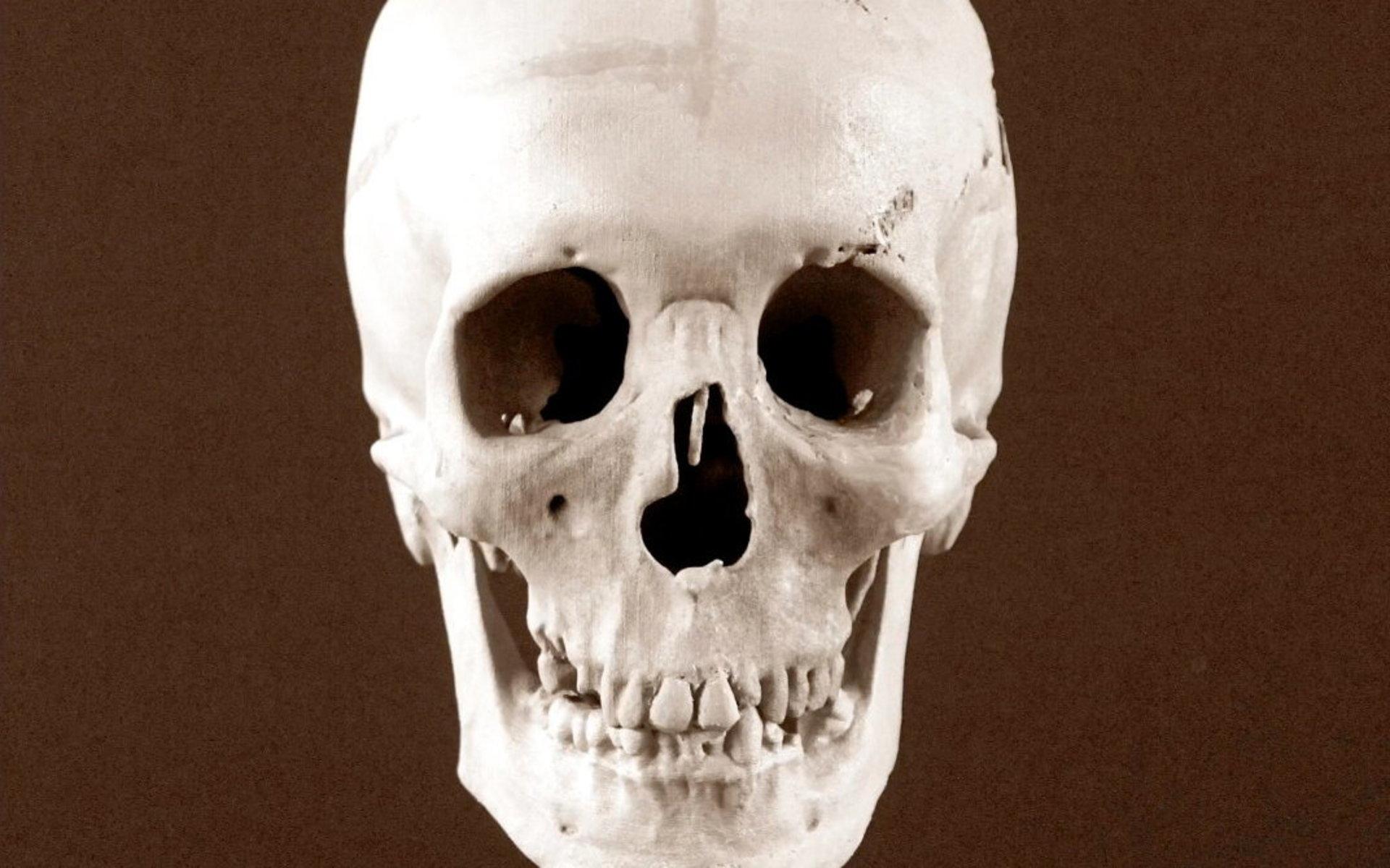 Utgångspunkten är förstås skallen. ”Våra utseenden beror till stor del på hur skallen är formad”, säger Oscar Nilsson. Kraniet är en modell skapad från en 3D-modell av brottsoffrets kvarlevor.
