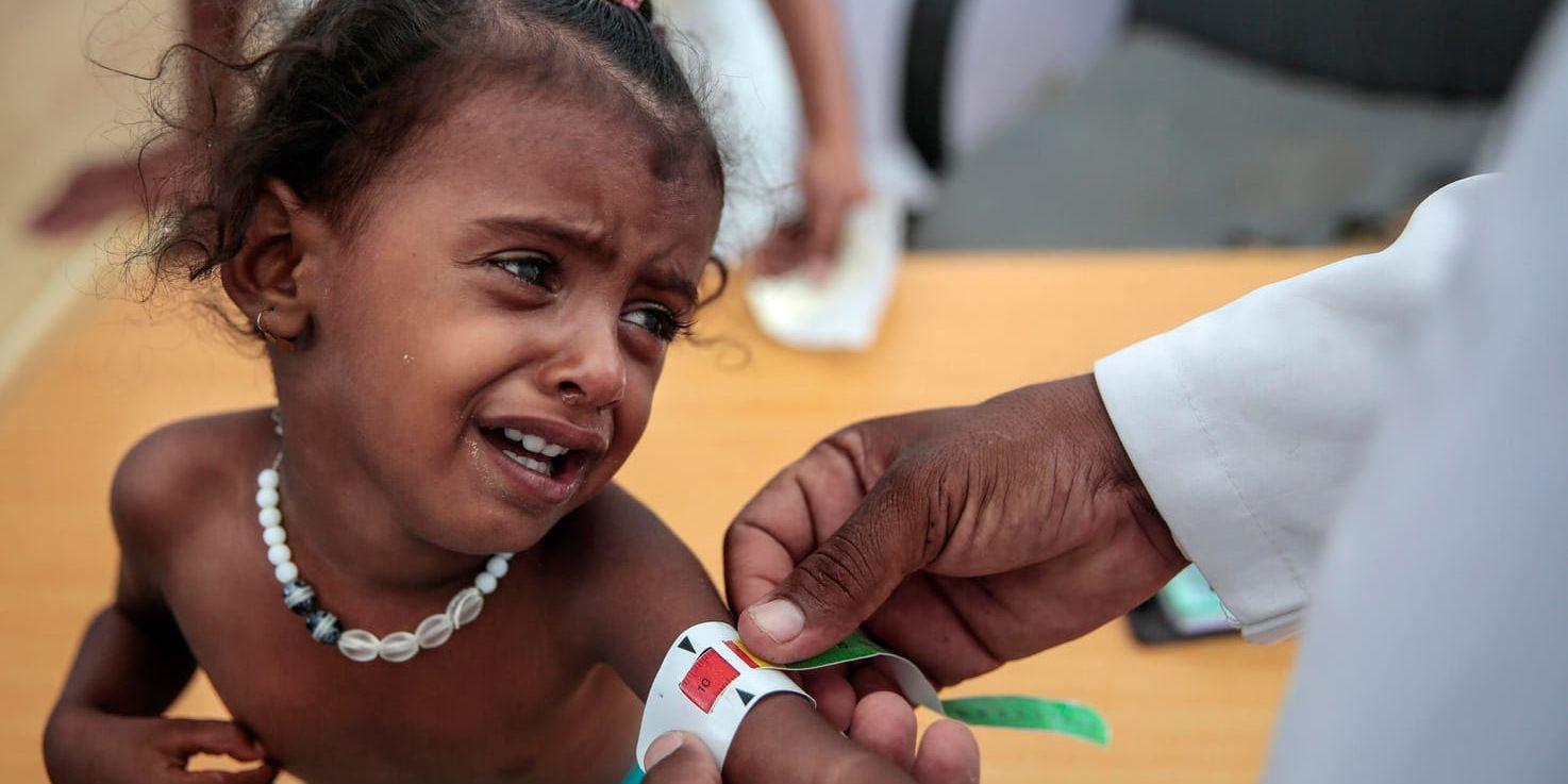 En läkare mäter armen på en undernärd flicka i Hajjah, Jemen.