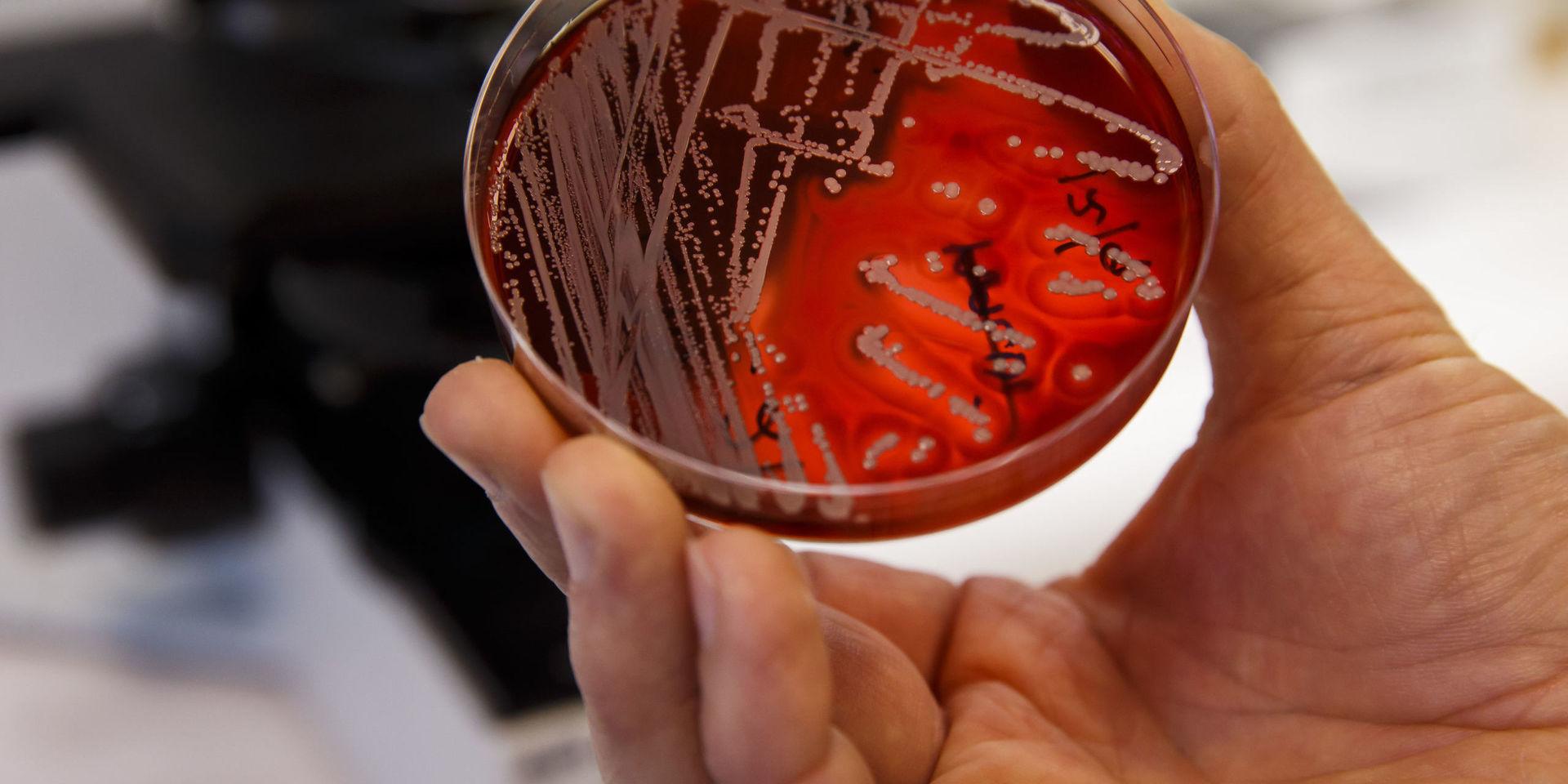 Världen kan ha fått ett nytt vapen mot antibiotikaresistenta bakterier. Arkivbild.